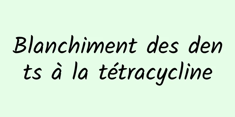 Blanchiment des dents à la tétracycline