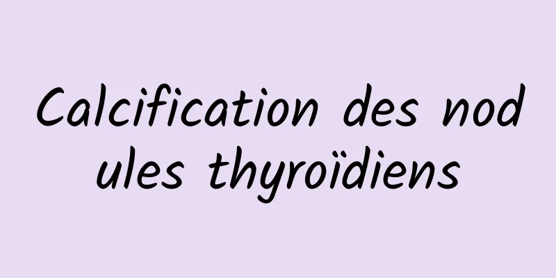 Calcification des nodules thyroïdiens