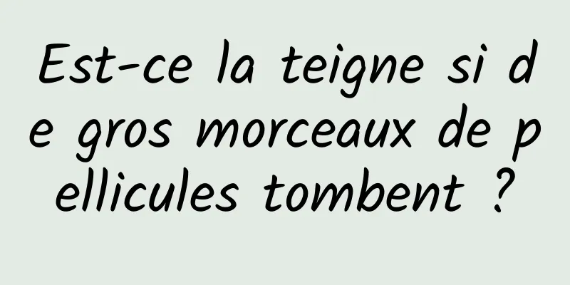 Est-ce la teigne si de gros morceaux de pellicules tombent ?