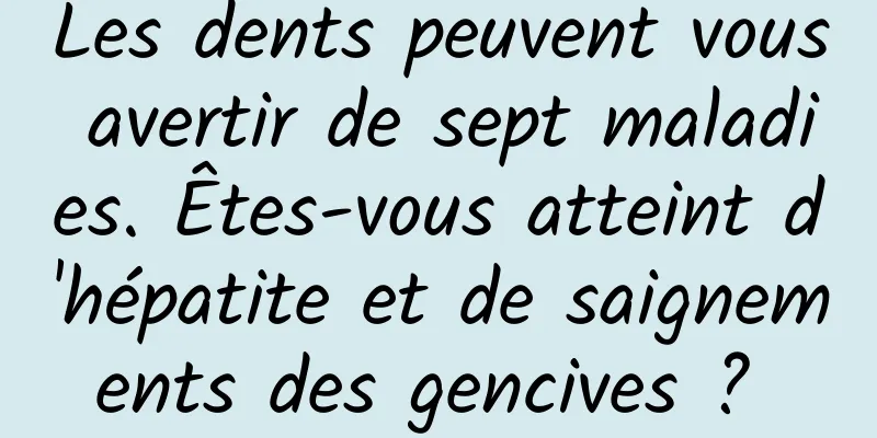 Les dents peuvent vous avertir de sept maladies. Êtes-vous atteint d'hépatite et de saignements des gencives ? 